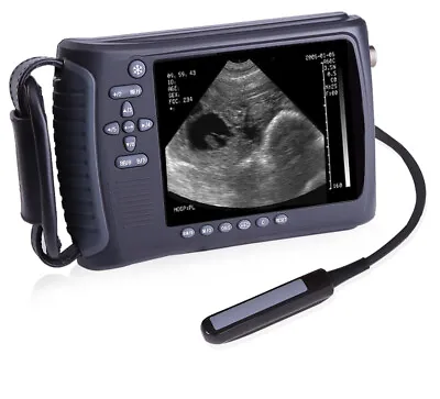Full Digital Palmtop Bladder Ultrasound Scanner Color Machine With Convex Probe • $1766.90