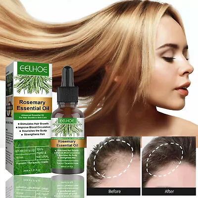 Rosemary Essential Oil For Hair Growth 100% Pure Natural Therapeutic Grade Safe • $6.49