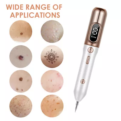 Laser Plasma Pen Mole Removal Dark Spot Skin Tag Tattoo Mole Wart Remover US • $18.69