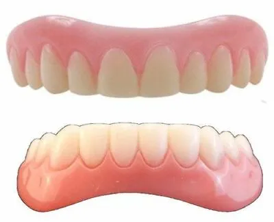 SMALL Instant Smile Both Uppers & Lowers 2 Extra Bags Of Fitting Beads • $25.95