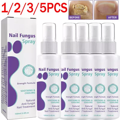 2023 NEW Medinail Fungus Spray Toenail Fungus Treatment Nail Fungus Treatment • $8.99