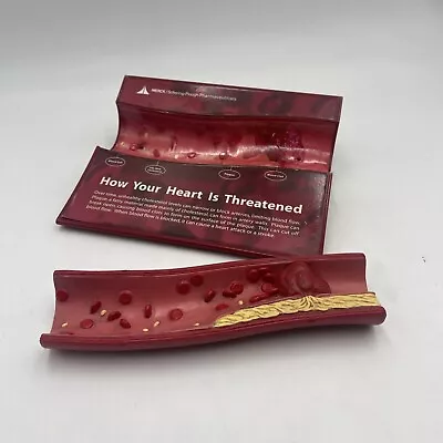 Merck Atherosclerosis Artery Heart Disease Anatomical Pathology Model • $29