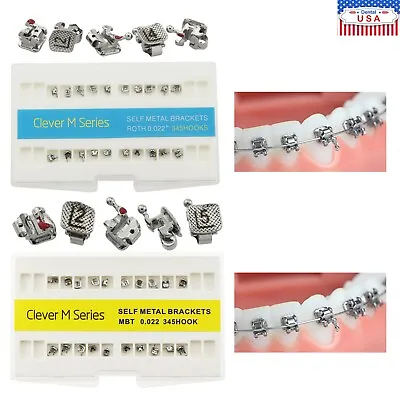 Dental Orthodontic Self-Ligating Brackets Metal Roth MBT 022 345 Clever M AO GAC • $59.99