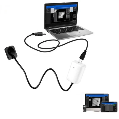 $619.91 • Buy Woodpecker Style Dental X Ray Imaging RVG X-Ray Sensor Size 1.0 With Software