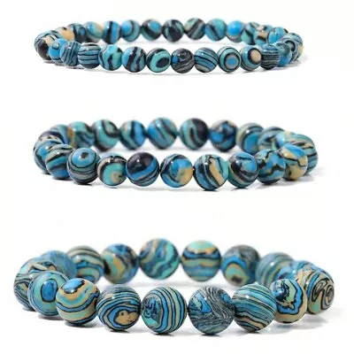 BLUE Malachite Bracelets Crystals Women Men Energy Healing Anxiety Bracelet A907 • £8.95