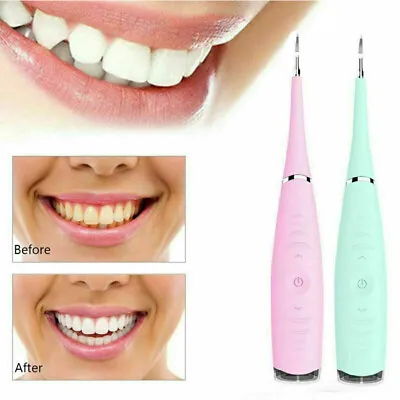 £7.39 • Buy Electric Sonic Dental Scaler Plaque Tartar Calculus Remover Tooth Stains Tools#