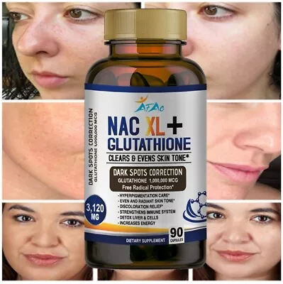 L Glutathione NAC Collagen Skin Whitening Lightening Dark Spots Acne Scar Remova • $15.99