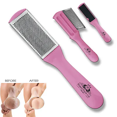 Foot Rasp File Callus Remover Hard Dead Rough Skin Scrubber Dual Sided Pedicure • £2.99