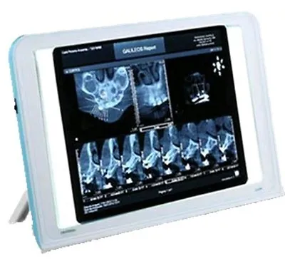 Dental X-Ray XRAY Film Viewer View Box LED Illuminator Wall Type Desk Mounting • $156.03