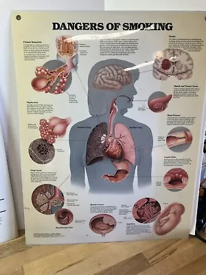 Vintage Medical Poster Anatomical Chart Company Dangers Of Smoking Hard Sided • $39.99