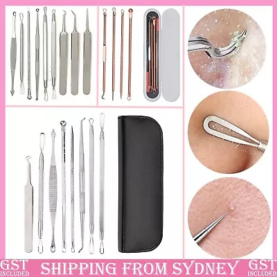 $5.50 • Buy Blackhead Extractor Tool Remover Pimple Popper Blemish Comedone Kit 4/8/9pcs