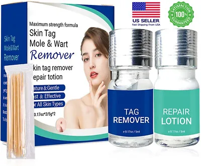 Skin Tag Remover And Repair Liquid Mole Corrector Wart Skin Tag Foot Corn Remove • $8.99