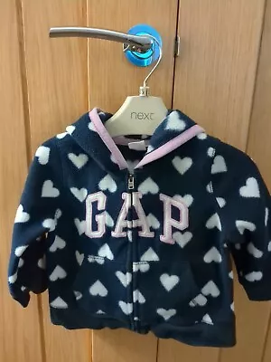 £3.50 • Buy Baby Gap Fleece Zip Up Hoodie 12 To 18 Months