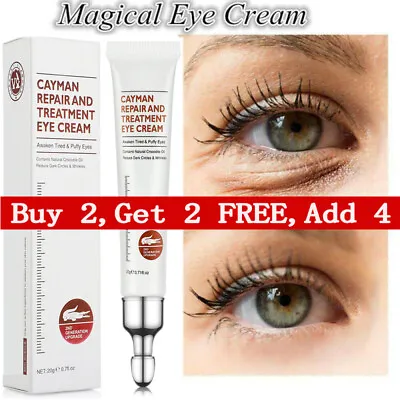 £7.95 • Buy Magic Eye Cream Instant Remove Eye Bags&dark Circles Eye Wrinkles&eye Depuffing