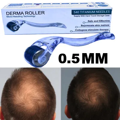 $20.99 • Buy DERMA ROLLER Hair Loss Treatment 540 Titanium Micro Needles Dermaroller 0.5 Mm  