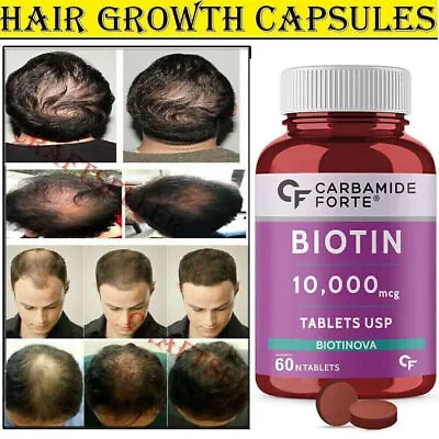 Viviscal Extra Strength Hair Growth Vitamin For Women Men Fast 60 Tab FREE SHIP. • $29.24