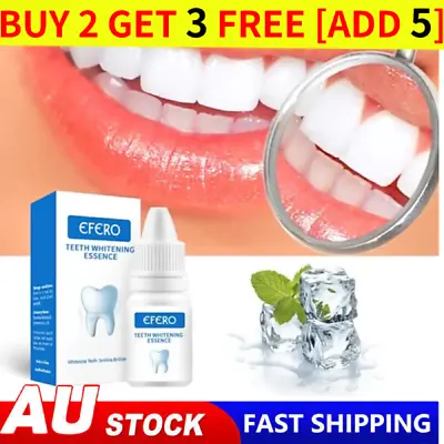 $11.89 • Buy New Instant Tooth Whitening Kit White Teeth Clean Gel Uv Bleach Dental
