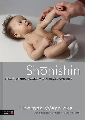 Shonishin: The Art Of Non-Invasive Paediatric Acupuncture By Thomas Wernicke (En • $45.12