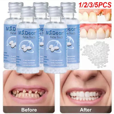 Resin False Teeth Solid Glue Temporary Tooth Repair Moldable Teeth Gap Filler US • $8.78