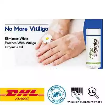 30ml & 50ml Vitiligo Organics For White Spots Patches Skin Repair RePigmentation • $74.50