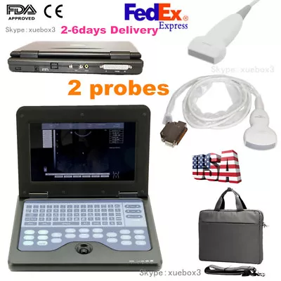 CMS600P2 Digital Portable Ultrasound Machine Laptop Scanner +Convex + Linear USA • $1649