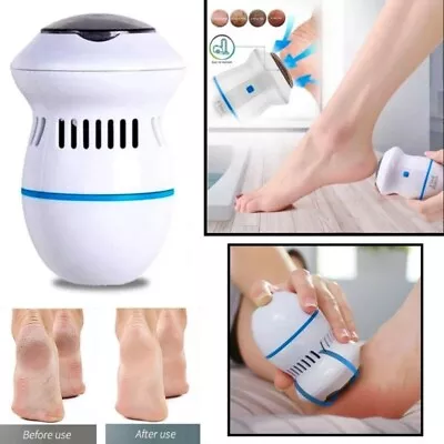 Foot Pedicure Grinder Remover Tool Automatic Polisher Dead Skin Callus Feet Care • £10.40