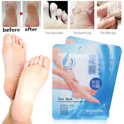 Feet Mask Sock Type Exfoliating Foot Mask Baby Soft Peel Dead Skin Hard Callus • £2.61