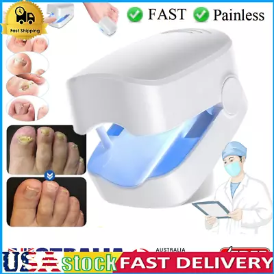 Nail Fungus Laser Device-Light Therapy Onychomycosis Toes Treatment Device NEW • $8.87