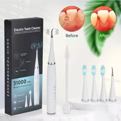 Ultrasonic Tooth Cleaner Electric Dental Scaler Plaque Remover Teeth Whitening • $21.39