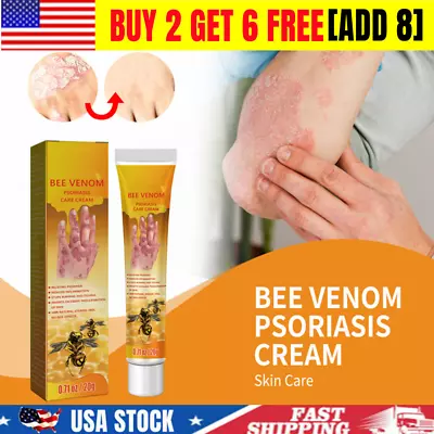 Bee Treatment Cream Dermatitis Eczema Ointment Healing Antibacterial Psoriasis • $7.49