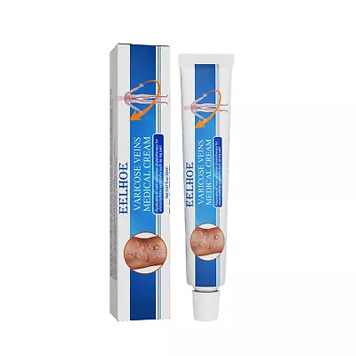 Blue Light Therapy Varicose Veins Pen +Cream Soft Sacr Removal Anti Varicose Set • £3.66