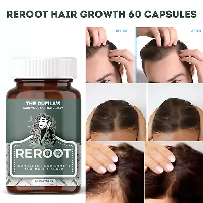 DHT Blocker Hair Growth Supplement High Potency Biotin & Saw Palmetto 60 Capsule • $47.27