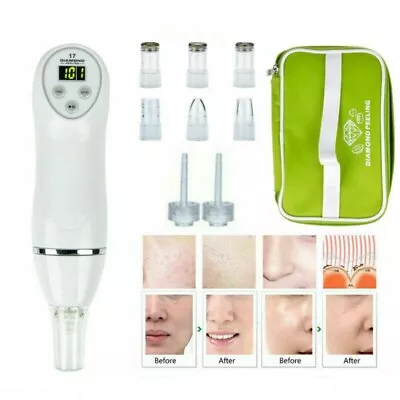 Pro Diamond Microdermabrasion Machine Tool Skin Dermabrasion Facial Peel Care UK • £23.85