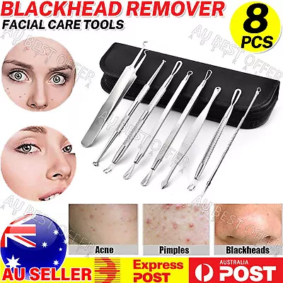 $5.85 • Buy Acne Clip Needle Pimple Popper Extractor Remover Curved Blackhead Tweezers AU