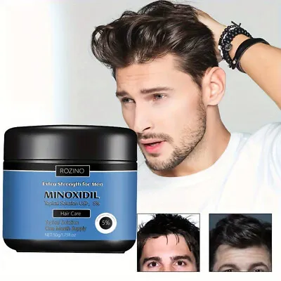 5% Minoxidil Extra Strength Mens Hair Loss Conditioner Mask Thicker Stronger • £5.95