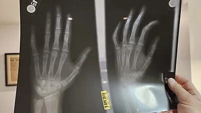 X-RAY Film Negatives Anatomy Hand Bones Halloween With Diagnosis Oddities  • $65