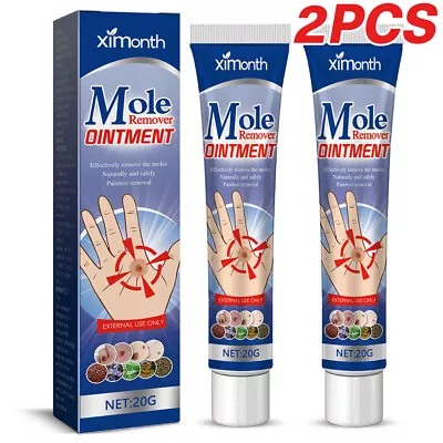 Wart Remover Cream Wipe Off Tags & Moles Remover Ointment For Body Face • £4.19