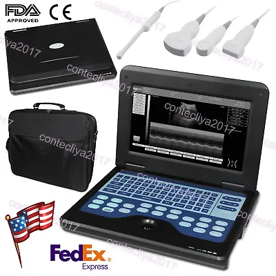 FDA CE 10.1 Inch Portable Ultrasound Scanner Laptop Machine CMS600P2 For Human • $2049
