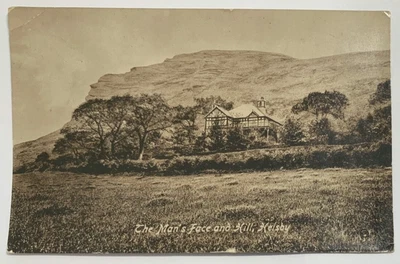 £1 • Buy Postcard Of The Man's Face And Hill, Helsby, Postmarked 1918