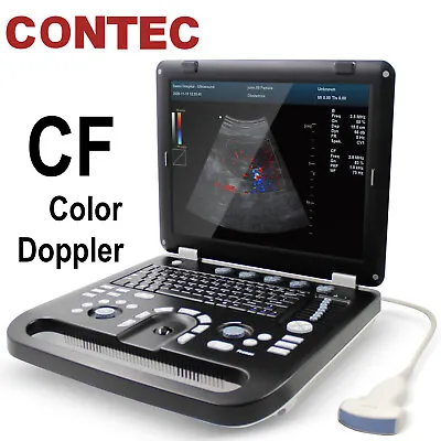 Portable Ultrasound Scanner Color Doppler Machine+ Convex Probe PW CWUSB+Video • $7999