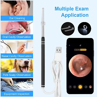 LED Ear Endoscope HD Otoscope Ear Wax Cleaning Camera Tool Cleaner Removal Kit • $10.99