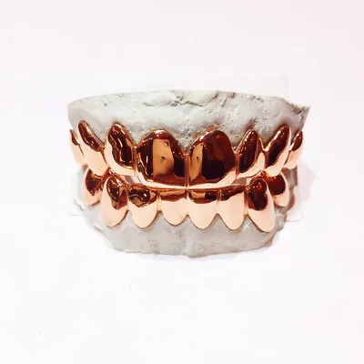 SOLID 10K 14K Solid ROSE Gold Custom Fit Plain REAL Gold Grill Grillz Gold Teeth • $675