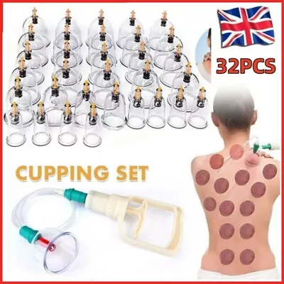 32PCS Cupping Vacuum Massage Cups Therapy Health Acupuncture Suction Magnet Set • £12.98