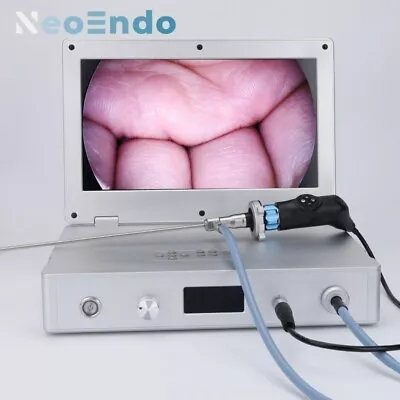 HD Portable Medical Endoscope Camera With 15.6 Inch Monitor 80W Light Source • $1950