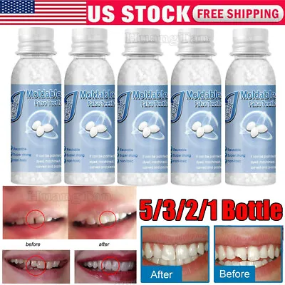 Temporary Tooth Repair Beads Granules For Cracked Tooth Gaps Broken Filling Glue • $8.78