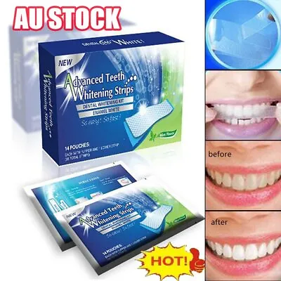 $12.37 • Buy 28 White Strip Teeth Whitening Strips Professional Advanced  Tooth Bleaching HQ