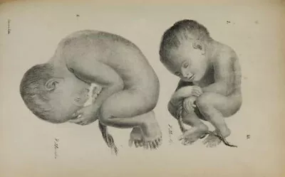 197 Antique Medical Science Books On Dvd- Midwifery Midwife Child Birth Medicine • £4.85