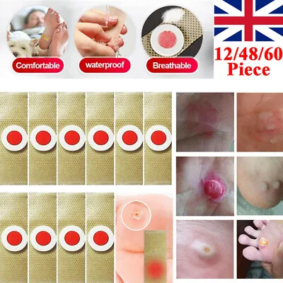 12-60x Foot Corn Remover Pads Wart Thorn Plaster Patch Therapy And Relieve Pain • £3.11