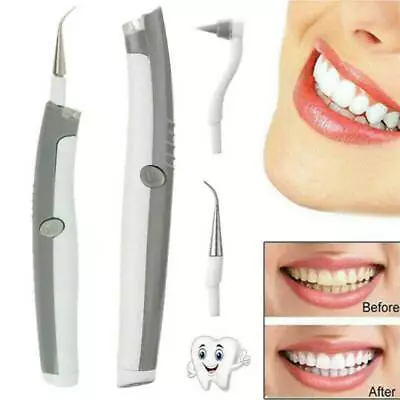 Adults Ultrasonic Tooth Cleaner Dental Scaler Stain Remover Teeth Cleaning ToolS • $15.49