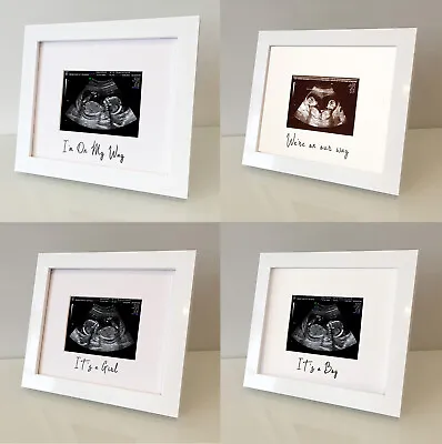 Personalised Baby Scan 12 & 20 Week Ultrasound Sonogram Print White Photo Frame • £12.95